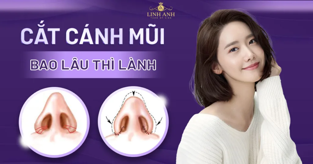 cắt cánh mũi bao lâu thì lành