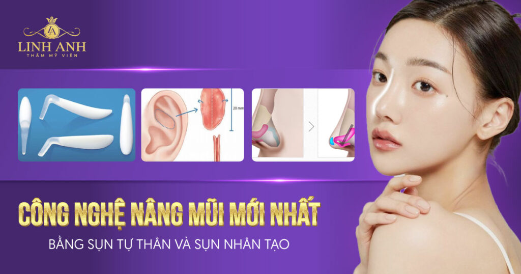 công nghệ nâng mũi mới nhất