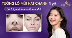 lỗ mũi hạt chanh