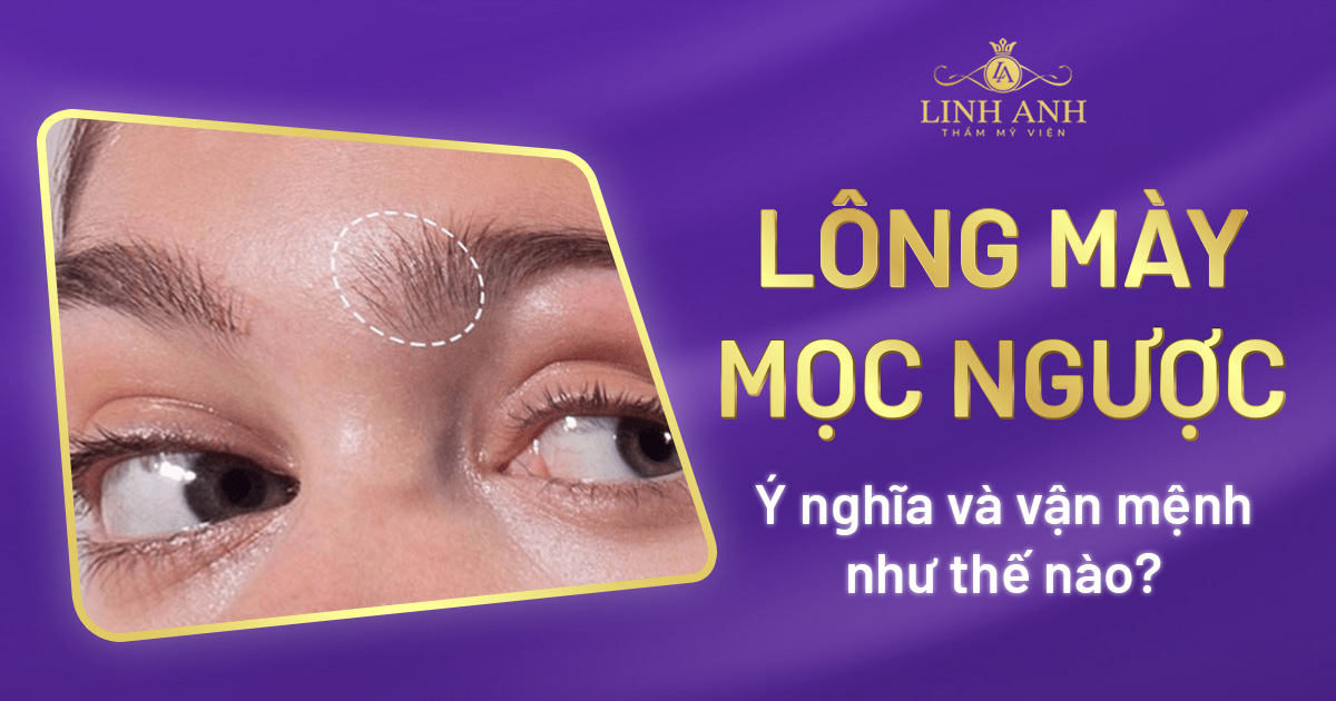 lông mày mọc ngược