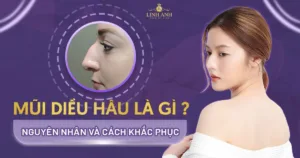 mũi diều hâu