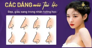 mũi tài lộc