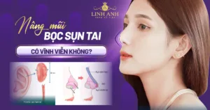 nâng mũi bọc sụn tai có vĩnh viễn không