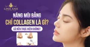 nâng mũi chỉ collagen