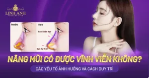 nâng mũi có được vĩnh viễn không