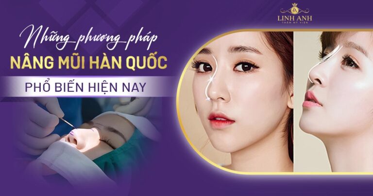 Nâng mũi Hàn Quốc là gì? Những phương pháp nâng mũi Hàn Quốc phổ biến