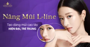 nâng mũi l line