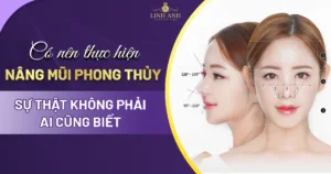 nâng mũi phong thủy