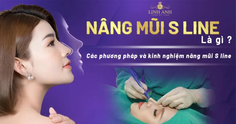 Nâng mũi S-line: Các phương pháp và kinh nghiệm giúp sở hữu dáng mũi đẹp