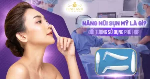 nâng mũi sụn mỹ