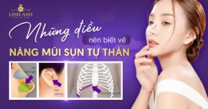 nâng mũi sụn tự thân