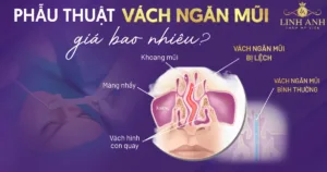 phẫu thuật vách ngăn mũi giá bao nhiêu