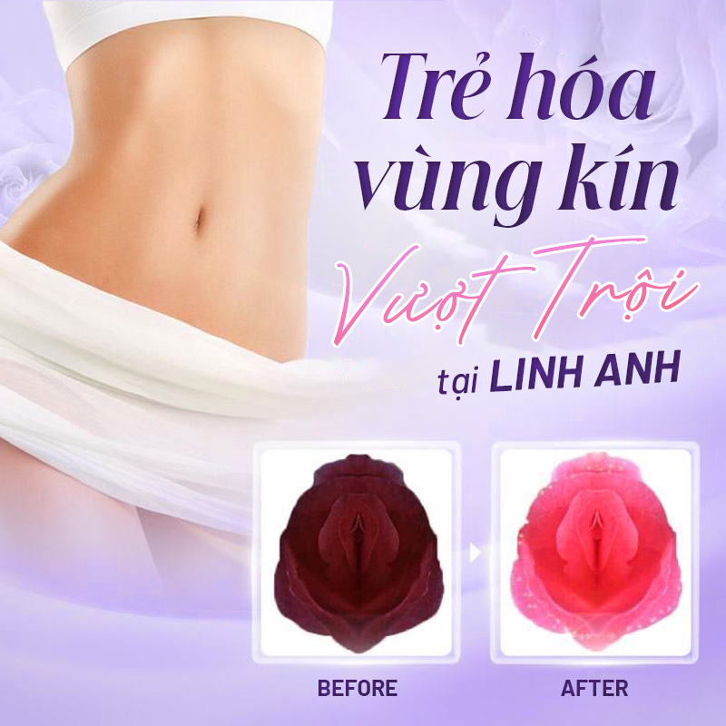 thẩm mỹ vùng kín ở đâu tphcm thẩm mỹ vùng kín ở đâu tphcm