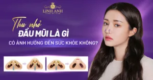 thu nhỏ đầu mũi