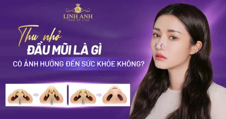 Phẫu thuật thu nhỏ đầu mũi – Tạo hình dáng mũi thon gọn, cân đối