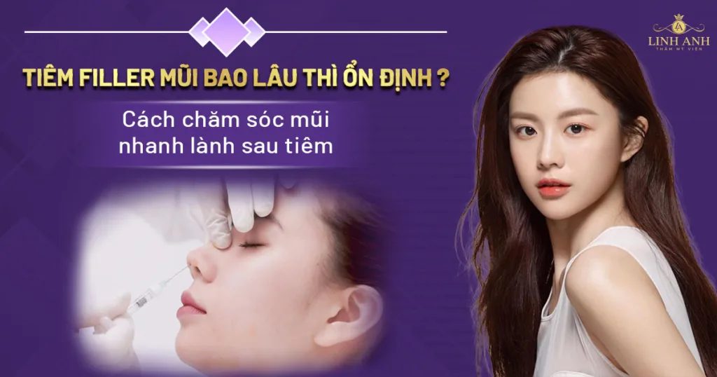 tiêm filler mũi bao lâu thì ổn định