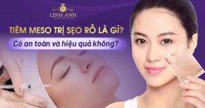 tiêm meso trị sẹo rỗ - Viện thẩm mỹ quốc tế Linh Anh