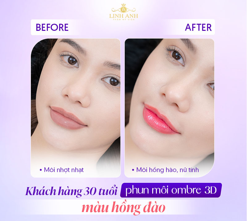 Khách hàng phun môi hồng đào tại Linh Anh