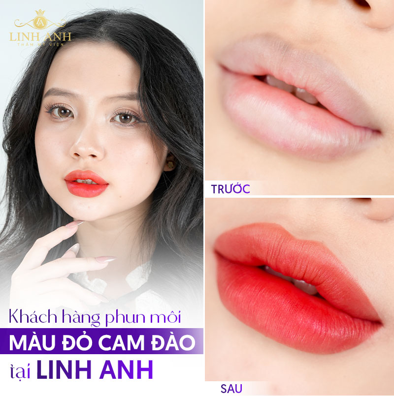 Khách hàng phun môi màu đỏ tại Linh Anh