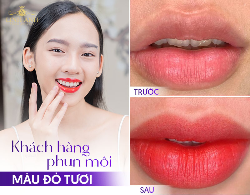 Khách hàng phun môi màu đỏ tươi tại Linh Anh