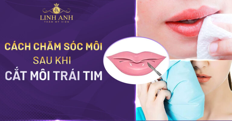 Cách chăm sóc môi sau khi cắt môi trái tim đúng cách
