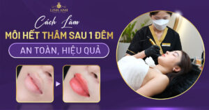 cách làm môi hết thâm sau 1 đêm