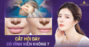 cắt môi dày có vĩnh viễn không - Viện thẩm mỹ quốc tế Linh Anh