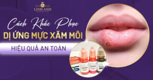 dị ứng mực xăm môi