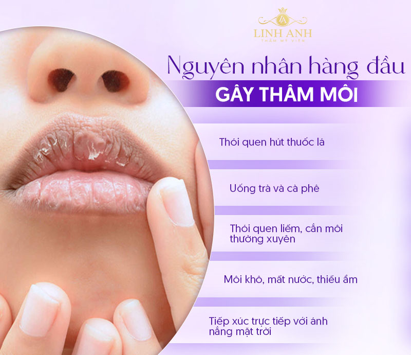 làm môi hết Thâm sau 1 đêm bằng cách nào