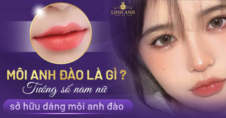 môi anh đào