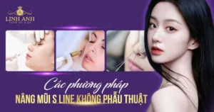 nâng mũi s line không phẫu thuật