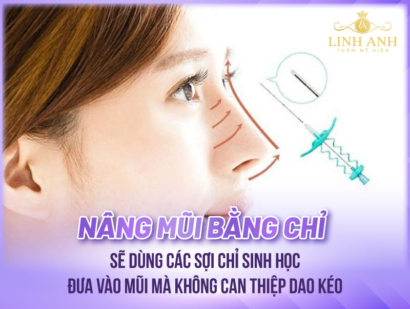 phương pháp nâng mũi s line không phẫu thuật