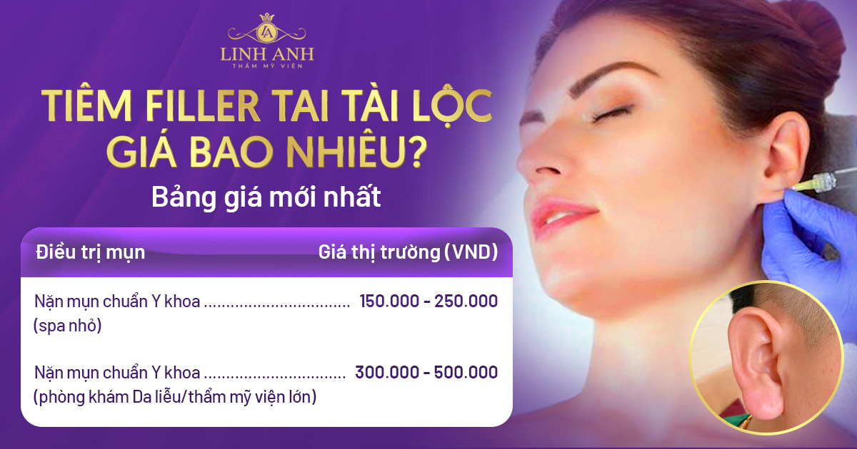 tiêm filler tai tài lộc giá bao nhiêu