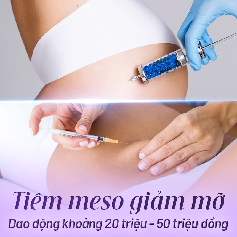 cấy meso giá bao nhiêu