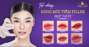 dáng môi tiêm filler đẹp