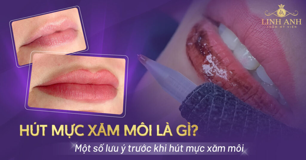 hút mực xăm môi