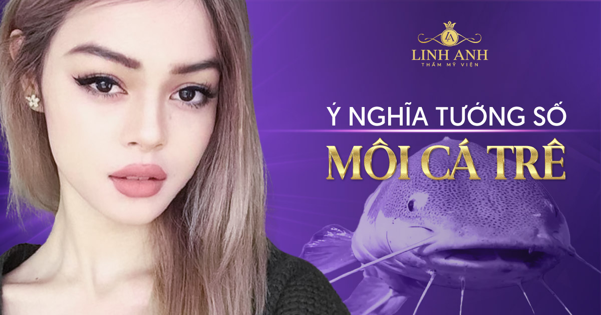 môi cá trê - Viện thẩm mỹ quốc tế Linh Anh