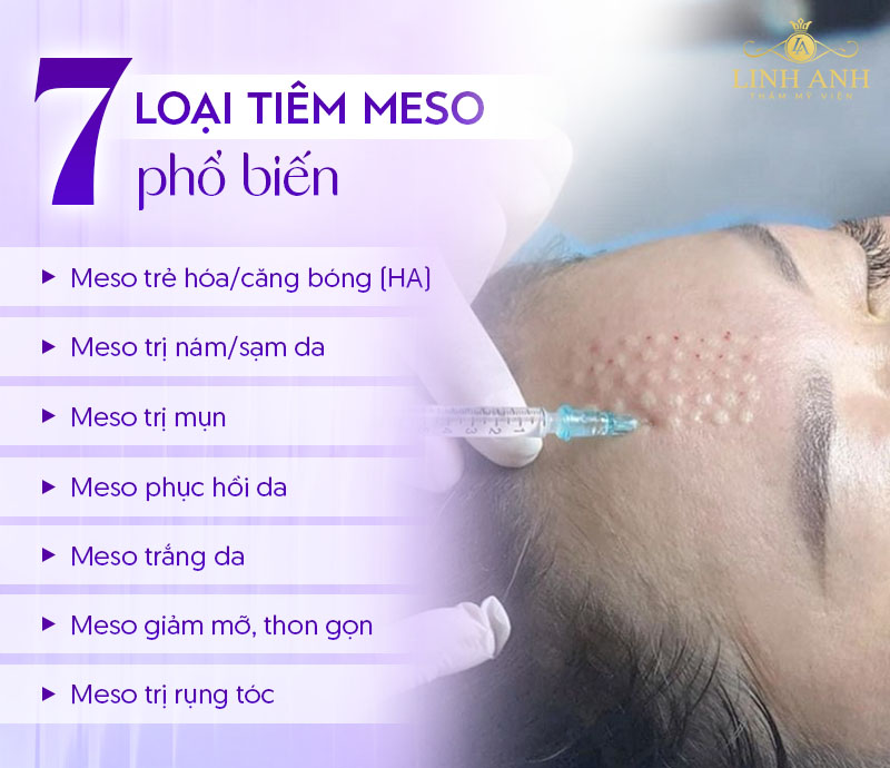 Tiêm meso có bao nhiêu loại Tiêm meso có bao nhiêu loại