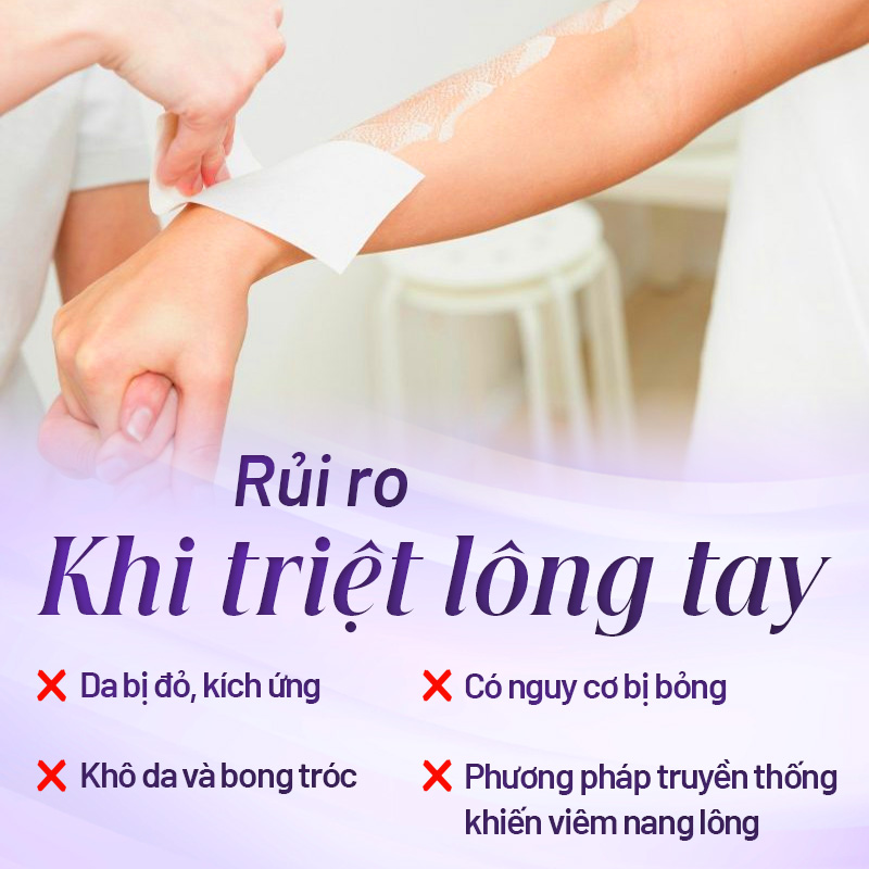 triệt lông tay hiệu quả