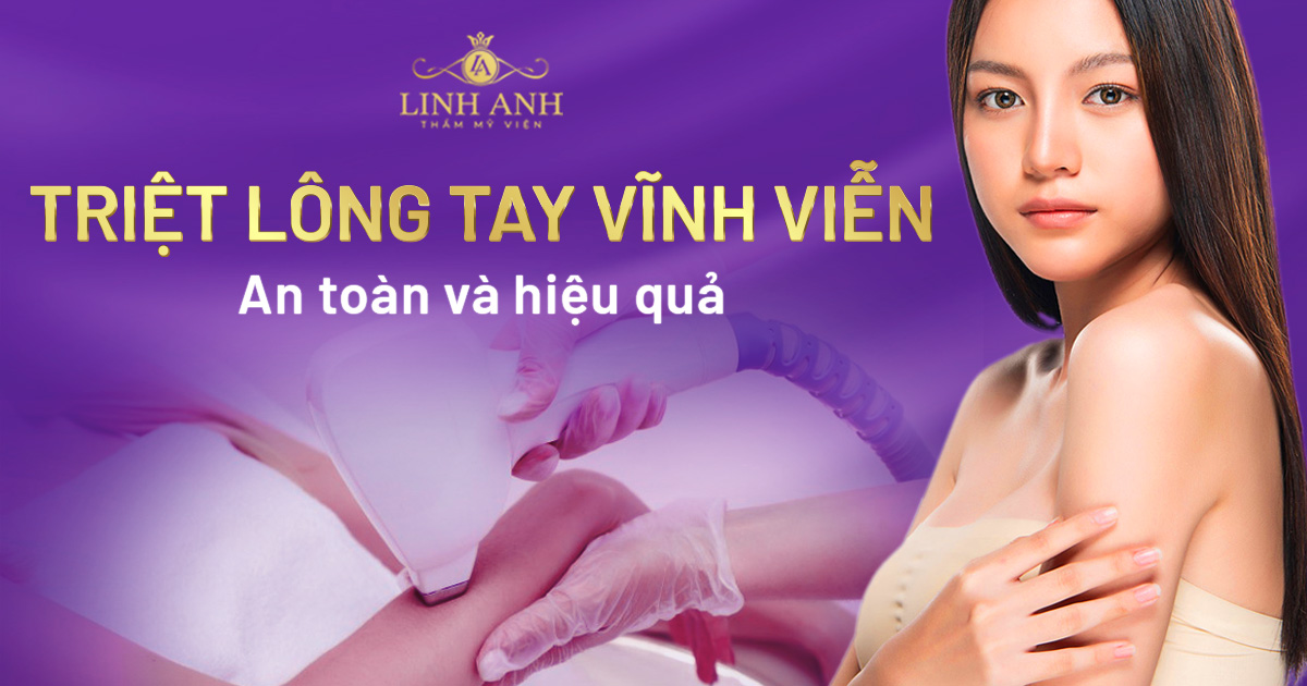 Triệt lông tay vĩnh viễn an toàn, hiệu quả bằng công nghệ cao