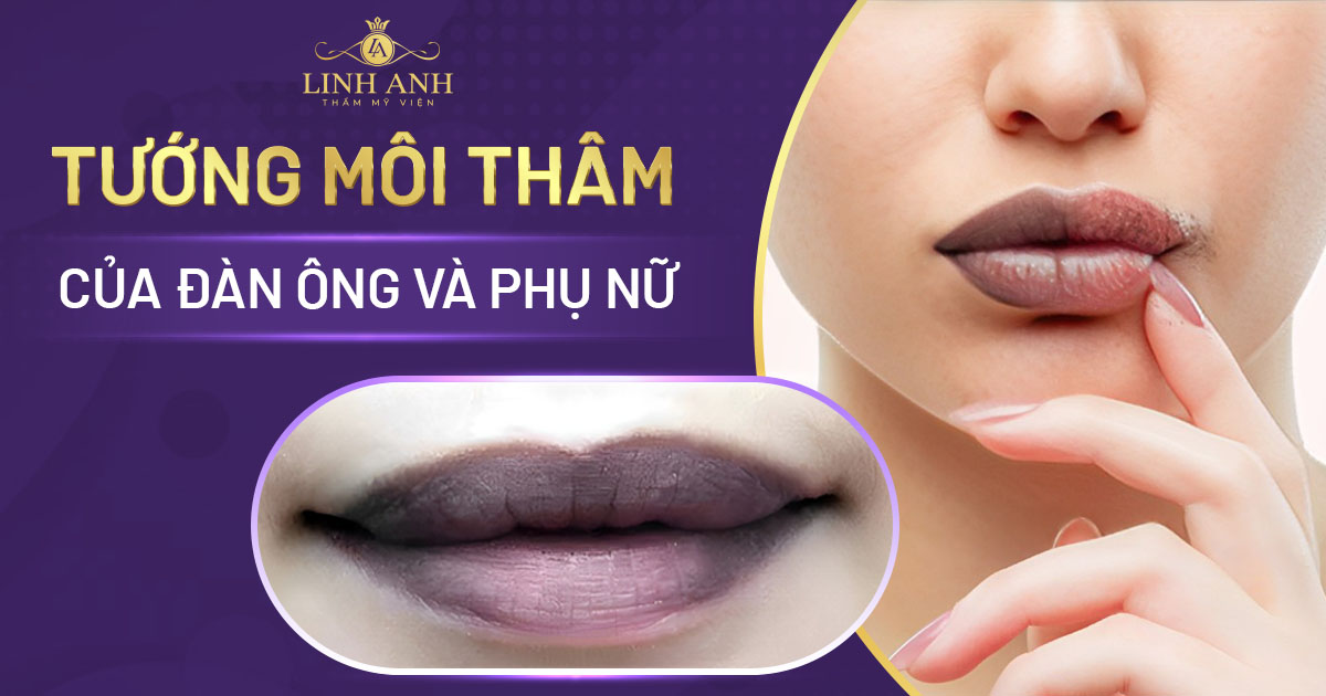 tướng môi thâm - Viện thẩm mỹ quốc tế Linh Anh