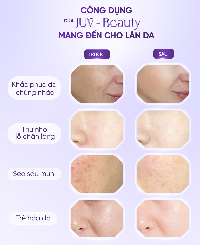 công nghệ trẻ hóa độc quyền juv beauty