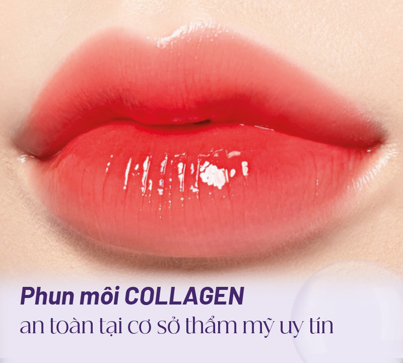 phun môi collagen có đau không