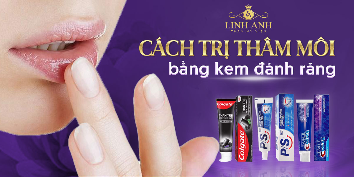 8 cách trị thâm môi bằng kem đánh răng an toàn tại nhà
