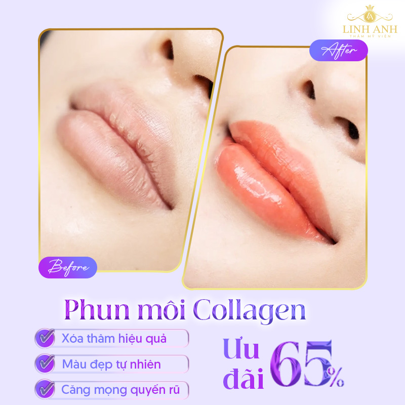 bảng giá phun xăm tại Linh Anh