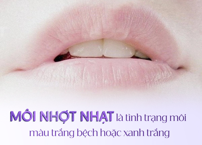 cách khắc phục môi nhợt nhạt