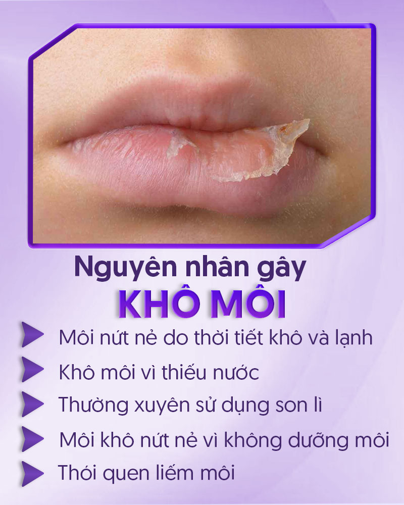 cách trị môi khô nứt nẻ chỉ trong 1 đêm