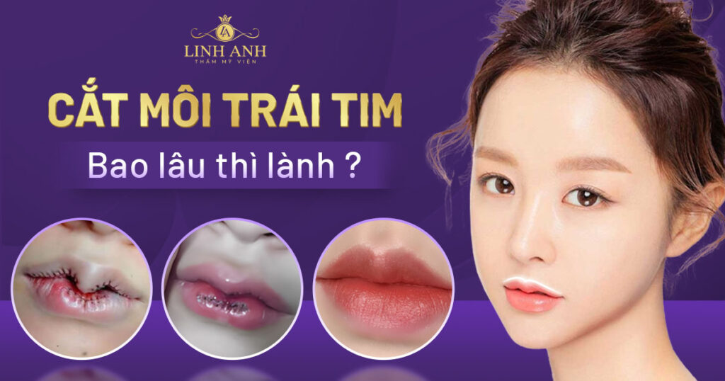 cắt môi trái tim bao lâu thì lành