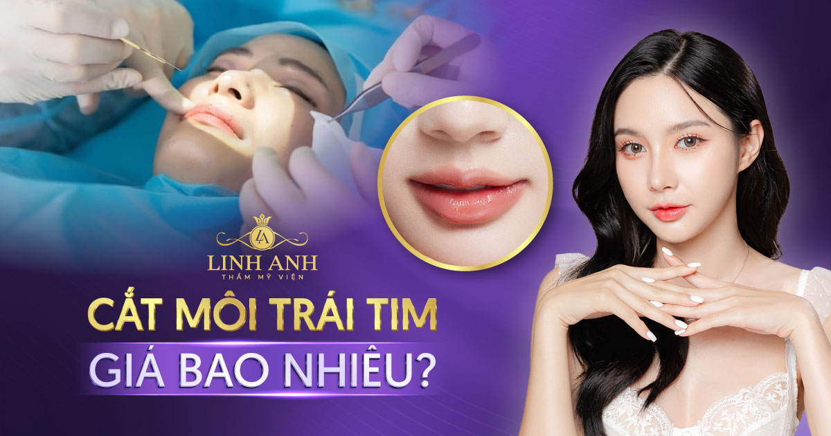 cắt môi trái tim giá bao nhiêu