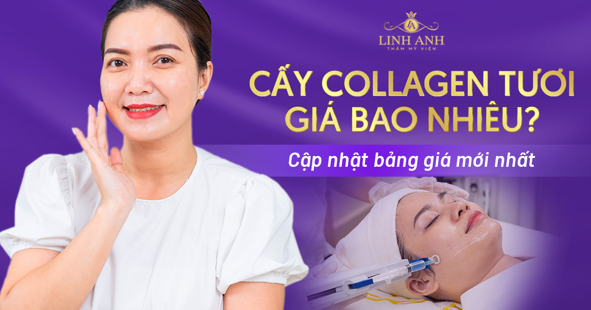 Cấy Collagen tươi giá bao nhiêu tiền? Bảng giá mới nhất